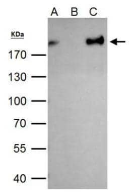 ZEB1 antibody immunoprecipitates ZEB1 protein in IP experiments. IP Sample: 293T whole cell lysate/extract A. 40 ug 293T whole cell lysate/extract B. Control with 2 ug of preimmune rabbit IgG C. Immunoprecipitation of ZEB1 protein by 2 ug of ZEB1 antibody (NBP2-20942) 7.5% SDS-PAGE The immunoprecipitated ZEB1 protein was detected by ZEB1 antibody (NBP2-20942) diluted at 1:1000. EasyBlot anti-rabbit IgG  was used as a secondary reagent. 