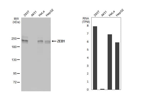 Various whole cell extracts (30 ug) were separated by 5% SDS-PAGE, and the membrane was blotted with ZEB1 antibody [N2C1], Internal (NBP2-20942) diluted at 1:1000. The HRP-conjugated anti-rabbit IgG antibody  was used to detect the primary antibody. Corresponding RNA expression data for the same cell lines are based on Human Protein Atlas program. 