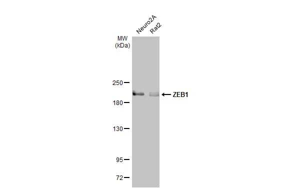 Various whole cell extracts (30 ug) were separated by 5% SDS-PAGE, and the membrane was blotted with ZEB1 antibody [N2C1], Internal (NBP2-20942) diluted at 1:1000. The HRP-conjugated anti-rabbit IgG antibody  was used to detect the primary antibody. 