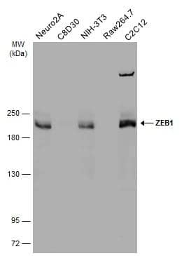 Various whole cell extracts (30 ug) were separated by 5% SDS-PAGE, and the membrane was blotted with ZEB1 antibody (NBP2-20942) diluted at 1:1000. The HRP-conjugated anti-rabbit IgG antibody  was used to detect the primary antibody. 