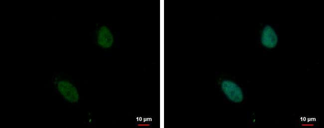 ZNF124 antibody detects ZNF124 protein at nucleus by immunofluorescent analysis.Sample: HeLa cells were fixed in 4% paraformaldehyde at RT for 15 min.Green: ZNF124 protein stained by ZNF124 antibody (NBP2-20961) diluted at 1:500.Blue: Hoechst 33342 staining.Scale bar = 10 um. 