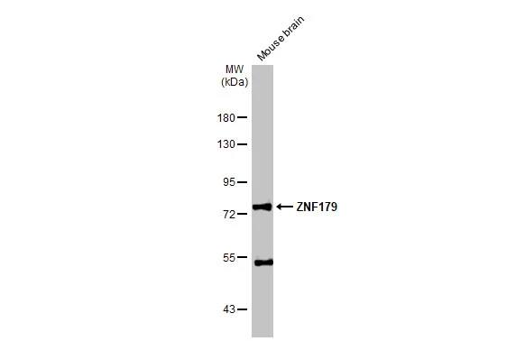 Western Blot: ZNF179 Antibody [NBP2-20966] - Mouse tissue extract (50 ug) was separated by 7.5% SDS-PAGE, and the membrane was blotted with ZNF179 antibody (NBP2-20966) diluted at 1:1000. The HRP-conjugated anti-rabbit IgG antibody  was used to detect the primary antibody.