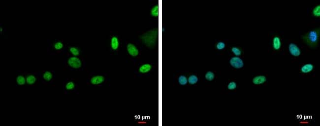 ZNF181 antibody detects ZNF181 protein at nucleus by immunofluorescent analysis.Sample: A549 cells were fixed in 4% paraformaldehyde at RT for 15 min.Green: ZNF181 protein stained by ZNF181 antibody (NBP2-20967) diluted at 1:500.Blue: Hoechst 33342 staining.Scale bar = 10 um. 