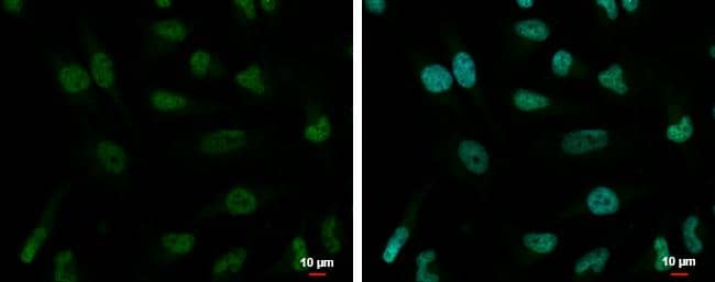 ZNF189 antibody detects ZNF189 protein at nucleus by immunofluorescent analysis.Sample: HeLa cells were fixed in 4% paraformaldehyde at RT for 15 min.Green: ZNF189 protein stained by ZNF189 antibody (NBP2-20971) diluted at 1:2000.Blue: Hoechst 33342 staining. 