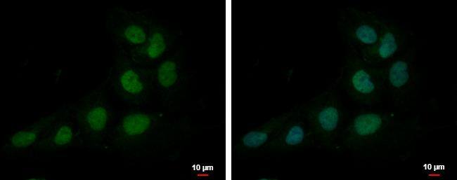 ZNF326 antibody [N1C1] detects ZNF326 protein at nucleus by immunofluorescent analysis.Sample: NT2D1 cells were fixed in 4% paraformaldehyde at RT for 15 min.Green: ZNF326 protein stained by ZNF326 antibody [N1C1] (NBP2-20992) diluted at 1:500.Blue: Hoechst 33342 staining. 