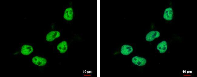 ZNF329 antibody detects ZNF329 protein at nucleus by immunofluorescent analysis.Sample: NT2D1 cells were fixed in 4% paraformaldehyde at RT for 15 min.Green: ZNF329 protein stained by ZNF329 antibody (NBP2-20993) diluted at 1:500.Blue: Hoechst 33342 staining. 
