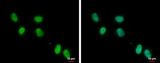 ZNF329 antibody [C1C3] detects ZNF329 protein at nucleus by immunofluorescent analysis.Sample: NT2D1 cells were fixed in 4% paraformaldehyde at RT for 15 min.Green: ZNF329 protein stained by ZNF329 antibody [C1C3] (NBP2-20994) diluted at 1:500.Blue: Hoechst 33342 staining.Scale bar = 10 um. 