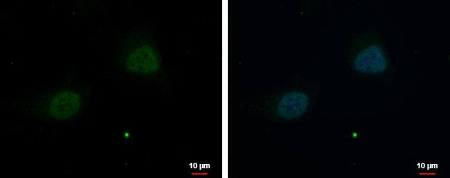 ZNF384 antibody [N1N2], N-term detects ZNF384 protein at nucleus by immunofluorescent analysis.Sample: HeLa cells were fixed in 4% paraformaldehyde at RT for 15 min.Green: ZNF384 protein stained by ZNF384 antibody [N1N2], N-term (NBP2-21002) diluted at 1:500.Blue: Hoechst 33342 staining.Scale bar = 10 um. 