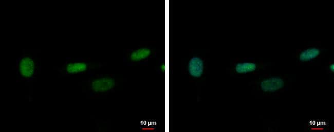 ZNF419 antibody [N2C2], Internal detects ZNF419 protein at nucleus by immunofluorescent analysis.Sample: SK-N-SH cells were fixed in 4% paraformaldehyde at RT for 15 min.Green: ZNF419 protein stained by ZNF419 antibody [N2C2], Internal (NBP2-21014) diluted at 1:500.Blue: Hoechst 33342 staining.Scale bar = 10 um. 