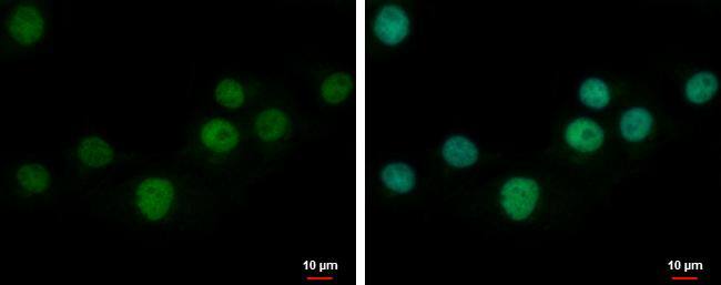 ZNF501 antibody [N2C3] detects ZNF501 protein at nucleus by immunofluorescent analysis.Sample: U87-MG cells were fixed in 4% paraformaldehyde at RT for 15 min.Green: ZNF501 protein stained by ZNF501 antibody [N2C3] (NBP2-21020) diluted at 1:500.Blue: Hoechst 33342 staining. 