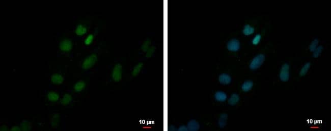 ZNF550 antibody detects ZNF550 protein at nucleus by immunofluorescent analysis.Sample: NT2D1 cells were fixed in 4% paraformaldehyde at RT for 15 min.Green: ZNF550 protein stained by ZNF550 antibody (NBP2-21025) diluted at 1:500.Blue: Hoechst 33342 staining.Scale bar = 10 um. 