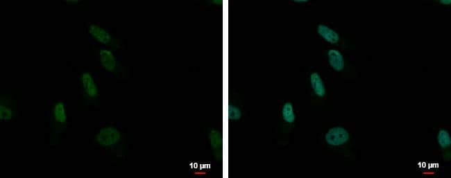 ZNF587 antibody [C1C3] detects ZNF587 protein at nucleus by immunofluorescent analysis.Sample: HeLa cells were fixed in 4% paraformaldehyde at RT for 15 min.Green: ZNF587 protein stained by ZNF587 antibody [C1C3] (NBP2-21031) diluted at 1:1000.Blue: Hoechst 33342 staining.Scale bar = 10 um. 