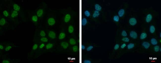 Immunocytochemistry/ Immunofluorescence ZNF596 Antibody