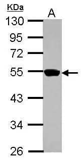 Western Blot ZNF597 Antibody - BSA Free