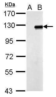 Sample (30 ug of whole cell lysate)  A: Non-transfected 293T lysates  B: ZNF711 transfected 293T lysate  7.5% SDS PAGE  NBP2-21046 diluted at 1:5000  
