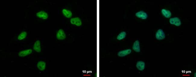 Immunocytochemistry/ Immunofluorescence ZNF76 Antibody - BSA Free