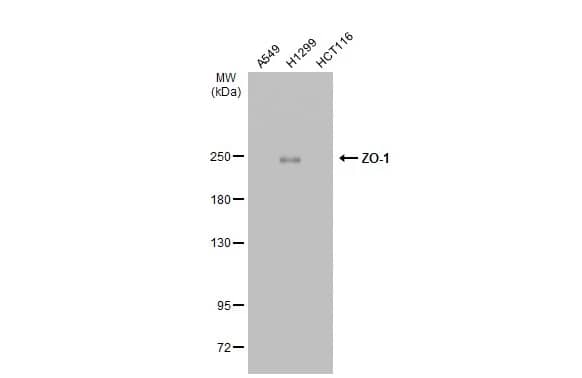 Western Blot: Tight Junction Protein 1 Antibody [NBP2-21051] - Various whole cell extracts (30 ug) were separated by 5% SDS-PAGE, and the membrane was blotted with Tight Junction Protein 1 antibody [N2C1], Internal (NBP2-21051) diluted at 1:2000. The HRP-conjugated anti-rabbit IgG antibody  was used to detect the primary antibody.