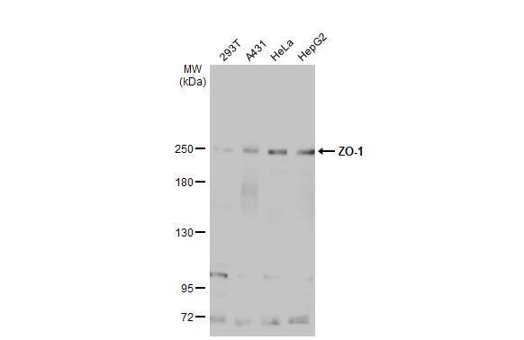 Various whole cell extracts (30 ug) were separated by 5% SDS-PAGE, and the membrane was blotted with ZO-1 antibody [N2C1], Internal (NBP2-21051) diluted at 1:1000. The HRP-conjugated anti-rabbit IgG antibody  was used to detect the primary antibody. 