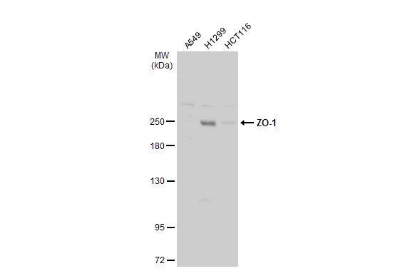 Various whole cell extracts (30 ug) were separated by 5% SDS-PAGE, and the membrane was blotted with ZO-1 antibody [N2C1], Internal (NBP2-21051) diluted at 1:2000. The HRP-conjugated anti-rabbit IgG antibody  was used to detect the primary antibody. 