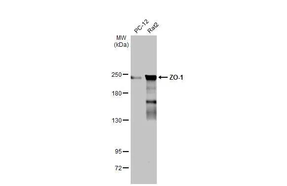 Various whole cell extracts (30 ug) were separated by 5% SDS-PAGE, and the membrane was blotted with ZO-1 antibody [N2C1], Internal (NBP2-21051) diluted at 1:1000. The HRP-conjugated anti-rabbit IgG antibody  was used to detect the primary antibody. 