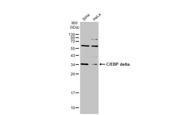 Various whole cell extracts (30 ug) were separated by 12% SDS-PAGE, and the membrane was blotted with C/EBP delta antibody [N1C3] (NBP2-21568) diluted at 1:500. The HRP-conjugated anti-rabbit IgG antibody  was used to detect the primary antibody. 