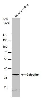 Mouse tissue extract (50 ug) was separated by 10% SDS-PAGE, and the membrane was blotted with Galectin4 antibody (NBP2-21573) diluted at 1:500. 