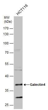 Whole cell extract (30 ug) was separated by 10% SDS-PAGE, and the membrane was blotted with Galectin4 antibody (NBP2-21573) diluted at 1:500. 