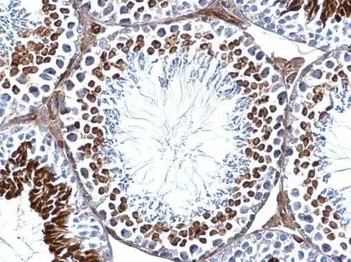 Immunohistochemistry GEF-H1 Antibody - BSA Free