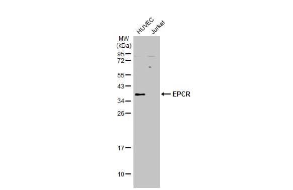 Western Blot: EPCR Antibody [NBP2-21578] - Various whole cell extracts (30 ug) were separated by 12% SDS-PAGE, and the membrane was blotted with EPCR antibody (NBP2-21578) diluted at 1:500. The HRP-conjugated anti-rabbit IgG antibody  was used to detect the primary antibody.