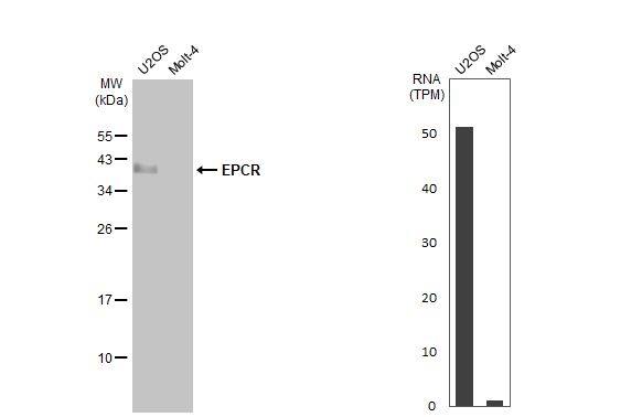 Various whole cell extracts (30 ug) were separated by 12% SDS-PAGE, and the membrane was blotted with EPCR antibody (NBP2-21578) diluted at 1:5000. The HRP-conjugated anti-rabbit IgG antibody  was used to detect the primary antibody. Corresponding RNA expression data for the same cell lines are based on Human Protein Atlas program. 