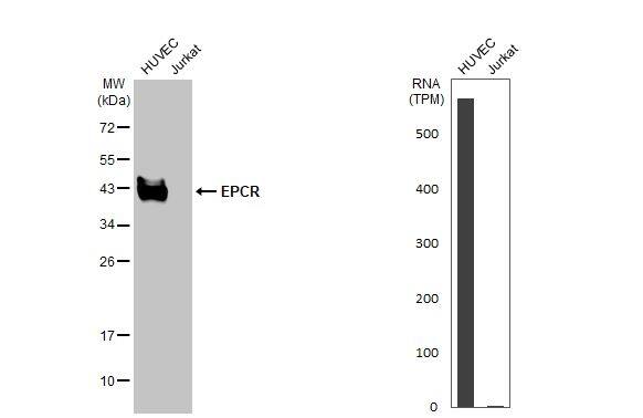 Various whole cell extracts (30 ug) were separated by 12% SDS-PAGE, and the membrane was blotted with EPCR antibody (NBP2-21578) diluted at 1:1250. The HRP-conjugated anti-rabbit IgG antibody  was used to detect the primary antibody. Corresponding RNA expression data for the same cell lines are based on Human Protein Atlas program. 