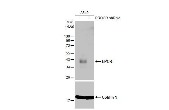<b>Genetic Strategies Validation. </b>Non-transfected (-) and transfected (+) A549 whole cell extracts (30 ug) were separated by 12% SDS-PAGE, and the membrane was blotted with EPCR antibody (NBP2-21578) diluted at 1:5000. The HRP-conjugated anti-rabbit IgG antibody  was used to detect the primary antibody. 