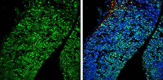 Immunohistochemistry-Frozen POU3F2/OCT7 Antibody