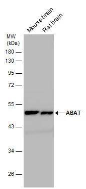 Western Blot ABAT Antibody - BSA Free