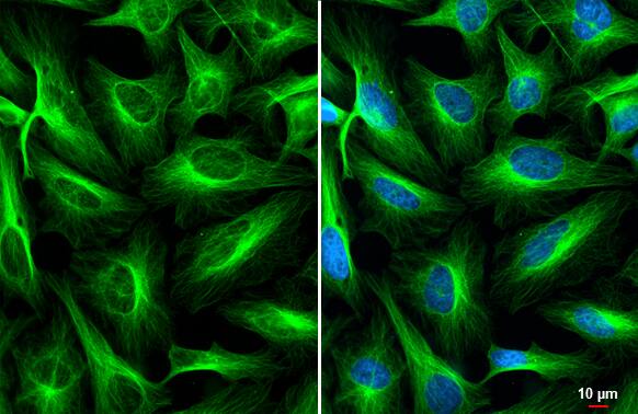 Immunocytochemistry/ Immunofluorescence: alpha Tubulin 4a Antibody [NBP2-21604] - alpha Tubulin 4a antibody detects alpha Tubulin 4a protein at cytoskeleton by immunofluorescent analysis.Sample: HeLa cells were fixed in 4% paraformaldehyde at RT for 15 min.Green: alpha Tubulin 4a stained by alpha Tubulin 4a antibody (NBP2-21604) diluted at 1:500.Blue: Fluoroshield with DAPI .