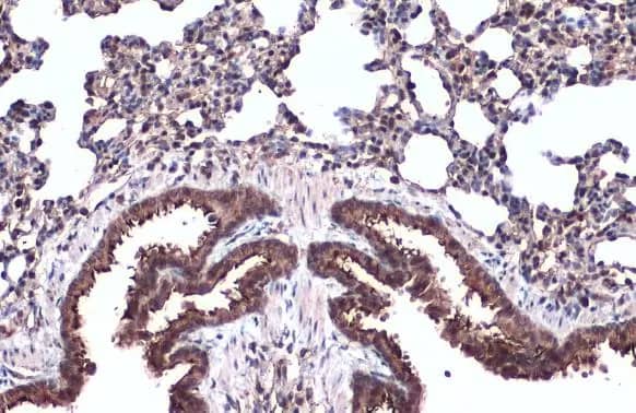 Immunohistochemistry-Paraffin: alpha Tubulin 4a Antibody [NBP2-21604] - alpha Tubulin 4a antibody detects alpha Tubulin 4a protein at cell membrane and cytoplasm by immunohistochemical analysis.Sample: Paraffin-embedded mouse lung.alpha Tubulin 4a stained by alpha Tubulin 4a antibody (NBP2-21604) diluted at 1:500.Antigen Retrieval: Citrate buffer, pH 6.0, 15 min