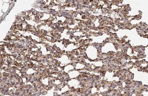 Immunohistochemistry-Paraffin: alpha Tubulin 4a Antibody [NBP2-21604] - alpha Tubulin 4a antibody detects alpha Tubulin 4a protein at cytoplasm and nucleus by immunohistochemical analysis.Sample: Paraffin-embedded rat lung.alpha Tubulin 4a stained by alpha Tubulin 4a antibody (NBP2-21604) diluted at 1:500.Antigen Retrieval: Citrate buffer, pH 6.0, 15 min