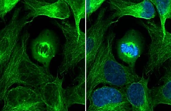 Immunocytochemistry/ Immunofluorescence alpha Tubulin 4a Antibody - BSA Free