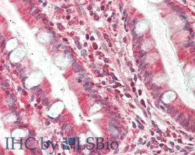 Immunohistochemistry of TIMP-4 Antibody (9:4-7).  Tissue: human small intestine.  Fixation: formalin fixed paraffin embedded.  Antigen retrieval: not required. Primary antibody: anti-TIMP4 antibody at 10 ug/mL for 1 h at RT. Secondary antibody: Peroxidase mouse secondary antibody at 1:10,000 for 45 min at RT. Staining: TIMP4 as precipitated red signal with hematoxylin purple nuclear counterstain.