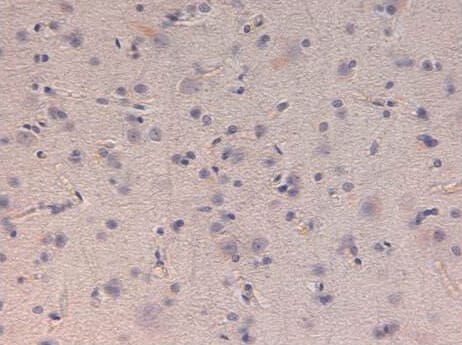 Immunohistochemistry of Rabbit anti-Kinesin-1. Tissue: Human Brain at 40X at pH 6.