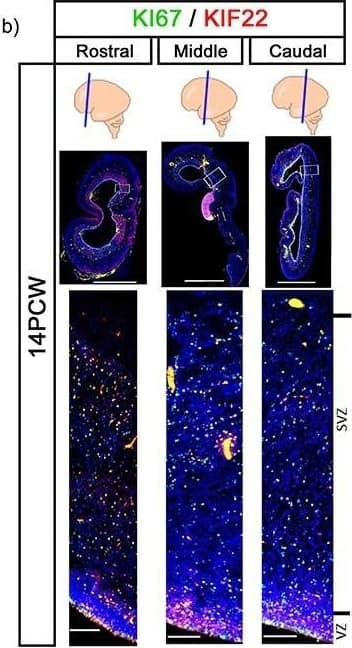 Immunofluorescence of KIF22 and KI67 proteins in the cortex. (a) KIF22 and KI67 at 12 PCW, low magnification scale bars = 4 mm, high magnification scale bars = 100 μm. (b) KIF22 and KI67 at 14 PCW, low magnification scale bars = 4 mm, high magnification scale bars = 100 μm. c) high magnification of KI67/KIF22 expressing cells. Scale bars = 10 μm. (d) Percentage of cells expressing KIF22, KI67, or both at 12 PCW. (e) Percentage of cells expressing KIF22, KI67, or both at 14 PCW. (f) Combined data of percentage of cells expressing KIF22, KI67, or both. Image collected and cropped by CiteAb from the following open publication (//pubmed.ncbi.nlm.nih.gov/33825894), licensed under a CC-BY license. Not internally tested by Novus Biologicals.