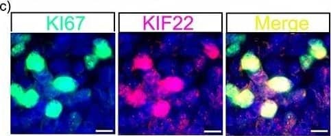 Immunofluorescence of KIF22 and KI67 proteins in the cortex. (a) KIF22 and KI67 at 12 PCW, low magnification scale bars = 4 mm, high magnification scale bars = 100 μm. (b) KIF22 and KI67 at 14 PCW, low magnification scale bars = 4 mm, high magnification scale bars = 100 μm. c) high magnification of KI67/KIF22 expressing cells. Scale bars = 10 μm. (d) Percentage of cells expressing KIF22, KI67, or both at 12 PCW. (e) Percentage of cells expressing KIF22, KI67, or both at 14 PCW. (f) Combined data of percentage of cells expressing KIF22, KI67, or both. Image collected and cropped by CiteAb from the following open publication (//pubmed.ncbi.nlm.nih.gov/33825894), licensed under a CC-BY license. Not internally tested by Novus Biologicals.