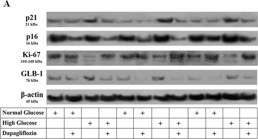 The effect of high glucose and dapagliflozin on cell cycle inhibitors p21 and p16, cell proliferation, and senescence. High glucose upregulated p21, while dapagliflozin normalized the p21 levels (A,B). Dapagliflozin downregulated p16 expression under normal and high-glucose conditions (A,C). High glucose decreased Ki-67, whereas dapagliflozin restored Ki-67 levels (A,D). High glucose increased GLB-1 expression, whereas dapagliflozin decreased GLB-1 under normal and high-glucose conditions (A,E). * p < 0.05 vs. control; # p < 0.05 vs. RPTECs treated with 15 ng/mL dapagliflozin; ^ p < 0.05 vs. RPTECs in high glucose; + p < 0.05 vs. RPTECs in high glucose and treated with 15 ng/mL dapagliflozin. GLB-1, beta-galactosidase; Ki-67, marker of proliferation Ki-67; p16, p16 INK4A, p21, p21 Waf1/Cip1. Image collected and cropped by CiteAb from the following open publication (//pubmed.ncbi.nlm.nih.gov/36555751), licensed under a CC-BY license. Not internally tested by Novus Biologicals.