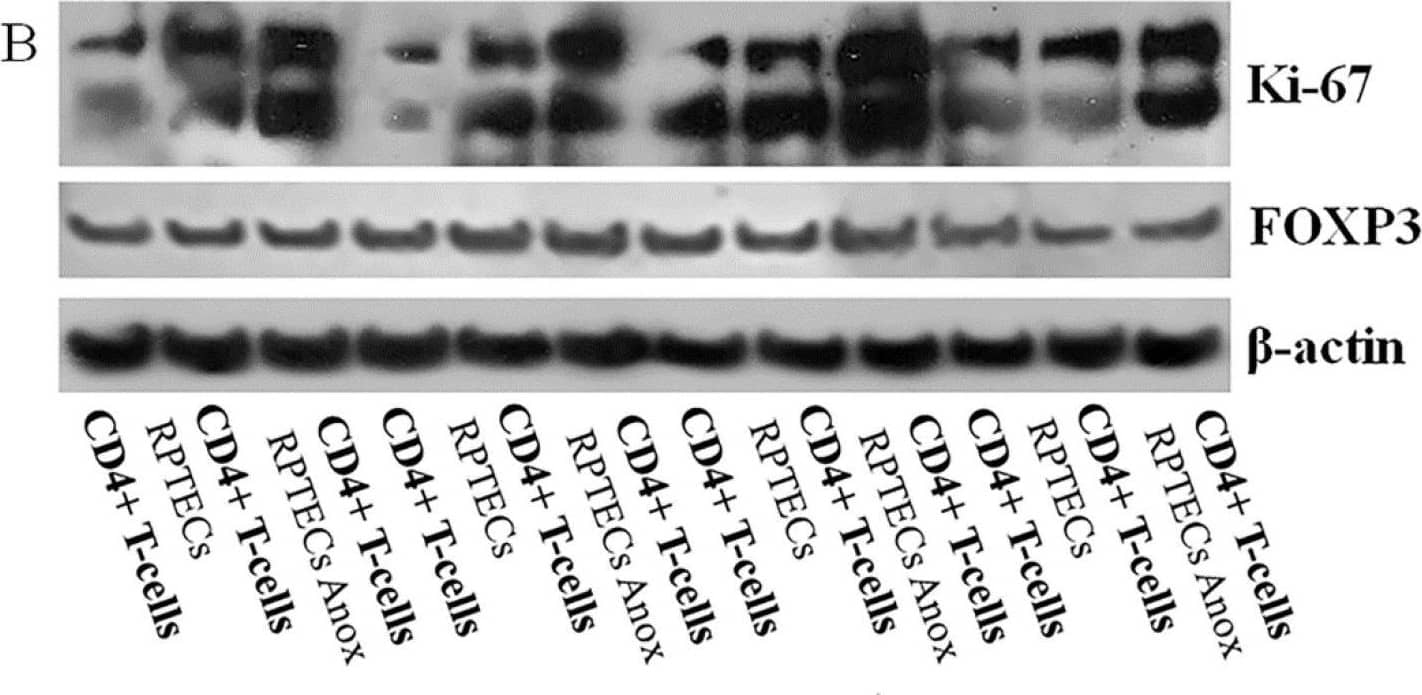 RPTECs trigger CD4+ T-cells to proliferate, anoxia-reoxygenation increases proliferation further, whereas CD4+ T-cell differentiation to regulatory T-cells does not occur. CD4+ T-cells were cultured alone or co-cultured with RPTECs for 7 days. RPTECs were previously subjected or not to 90 min of anoxia. Four such experiments were performed. Compared to isolated CD4+ T-cell culture, proliferation index was higher in RPTEC CD4+ T-cell co-culture and increased further in the case of previous RPTEC culture under anoxia. * indicates a p < 0.05 compared to isolated CD4+ T-cell culture, # a p < 0.05 compared to RPTEC CD4+ T-cell co-culture, and ^ a p < 0.05 compared to RPTEC (A). CD4+ T-cells were cultured alone or co-cultured with RPTECs. RPTECs were previously subjected or not to anoxia. After 3 days of co-culture, the CD4+ T-cells were collected. Four experiments were performed. Compared to isolated CD4+ T-cell culture, in CD4+ T-cell derived from RPTEC CD4+ T-cell co-culture Ki-67 (B,C) increased. Previous culture of RPTECs under anoxia induced further Ki-67 in CD4+ T-cells (B,C). FOXP3 expression in CD4+ T-cells remained unaffected under all conditions (B,D). The Western blotting results were normalized for  beta -actin and then depicted after normalization for the control group. Error bars correspond to SEM. * indicates a p < 0.05 compared to isolated CD4+ T-cell culture, # a p < 0.05 compared to CD4+ harvested from RPTEC CD4+ T-cell co-culture, and ^ a p < 0.05 compared to CD4+ collected from RPTEC CD4+ T-cell co-culture in which RPTECs were previously subjected to anoxia. Image collected and cropped by CiteAb from the following open publication (//pubmed.ncbi.nlm.nih.gov/33572206), licensed under a CC-BY license. Not internally tested by Novus Biologicals.