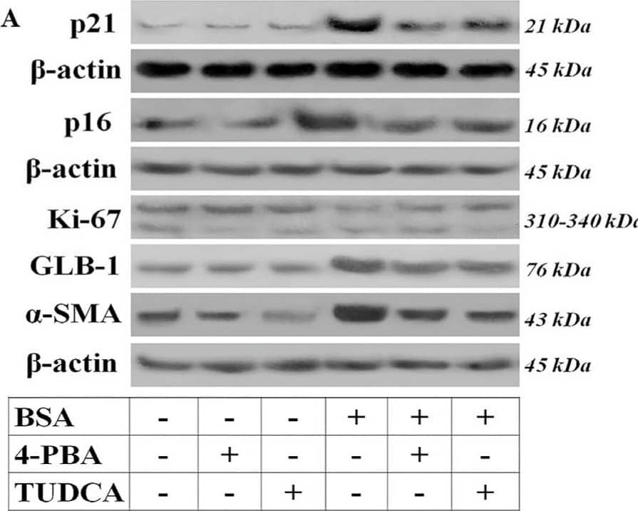 Albumin overload induces cellular senescence and EMT. Panel (A) depicts the results of one out of three performed experiments. Albumin overload increased the expression of the cell cycle arrest inducers p21 (B) and p16 (C). In addition, it decreased the level of the cell proliferation marker Ki-67 (D) and enhanced the cellular senescence marker GLB-1 (E). RPTECs exposed to high albumin concentration overproduced IL-1 beta  (F) and TGF-beta 1 (G). Exposure of RPTECs to high albumin concentration resulted in EMT as the level of  alpha -SMA increased (H). TUDCA and 4-PBA ameliorated but did not eliminate all the changes above. * p < 0.05 vs. control; # p < 0.05 vs. RPTECs treated with 4-PBA; ^ p < 0.05 vs. RPTECs treated with TUDCA; + p < 0.05 vs. RPTECs exposed to BSA; & p < 0.05 vs. RPTECs exposed to BSA and 4-PBA; ! p < 0.05 vs. RPTECs exposed to BSA and TUDCA. 4-PBA, 4-Phenylbutyric acid;  alpha -smooth muscle actin; BSA, bovine serum albumin; GLB-1,  beta -galactosidase; IL-1 beta , interleukin-1 beta ; Ki-67, marker of proliferation Ki-67; p16, p16 INK4A; p21, p21 Waf1/Cip1; TGF-beta 1, transforming growth factor-beta 1; TUDCA, tauroursodeoxycholic acid. Image collected and cropped by CiteAb from the following open publication (//pubmed.ncbi.nlm.nih.gov/37298591), licensed under a CC-BY license. Not internally tested by Novus Biologicals.