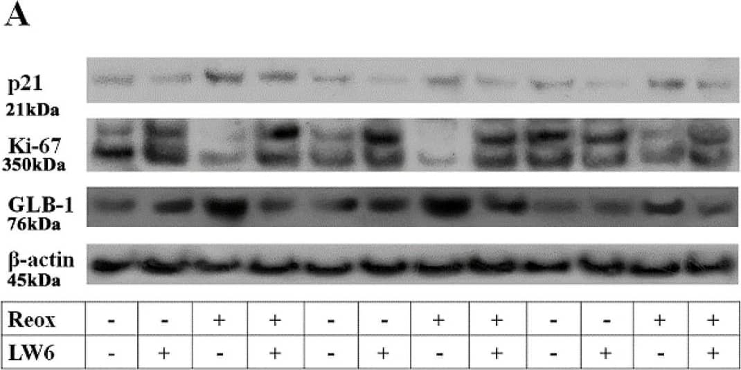 Anoxia-reoxygenation induces senescence phenotype, while LW6 prevents it. Anoxia-reoxygenation increases the p21 level, whereas the MDH-2 inhibitor LW6 prevents reoxygenation-induced p21 upregulation (A,B). Reoxygenation downregulated Ki-67, while LW6 prevented reoxygenation-induced Ki-67 reduction (A,C). Under reoxygenation, GLB-1 increased, but LW6 reversed the above change (A,D). RPTECs under reoxygenation produced more IL-1 beta , whereas LW6 downregulated reoxygenation-induced IL-1 beta  overproduction (E). * p < 0.05 vs. control; # p < 0.05 vs. LW6-treated RPTECs under normoxia; + p < 0.05 vs. RPTECs under reoxygenation, ^ p < 0.05 vs. LW6-treated RPTECs under reoxygenation. GLB-1, beta-galactosidase; IL-1 beta , interleukin-1 beta . Image collected and cropped by CiteAb from the following open publication (//pubmed.ncbi.nlm.nih.gov/36291624), licensed under a CC-BY license. Not internally tested by Novus Biologicals.