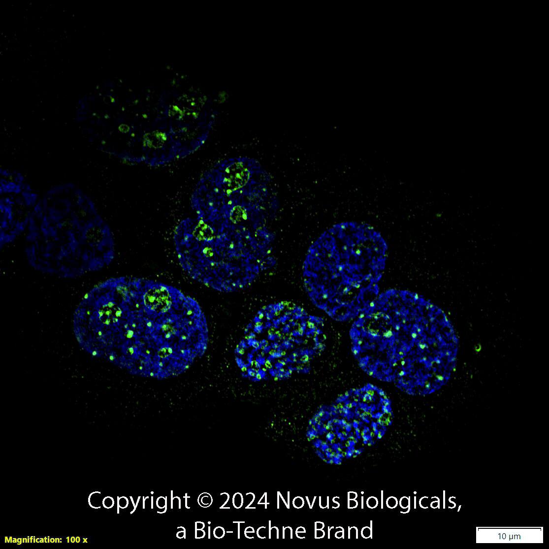 Ki67/MKI67 (8D5) was detected in immersion fixed A431 human skin carcinoma cell line using Mouse anti-Ki67/MKI67 (8D5) Protein-G purified Monoclonal Antibody conjugated to Alexa Fluor® 488 (Catalog # NBP2-22112AF488) (green) at 5 µg/mL overnight at 4C. Cells were counterstained with DAPI (blue). Cells were imaged using a 100X objective and digitally deconvolved.  