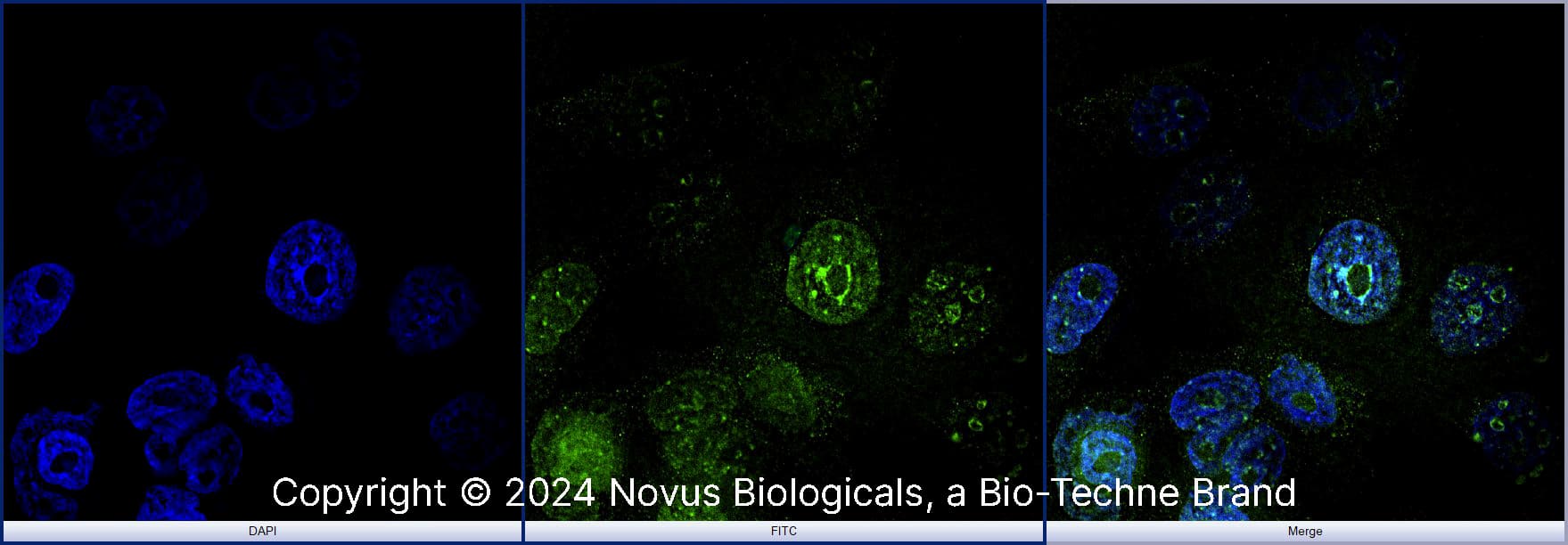 Ki67/MKI67 (8D5) was detected in immersion fixed A431 human skin carcinoma cell line using Mouse anti-Ki67/MKI67 (8D5) Protein-G purified Monoclonal Antibody conjugated to DyLight 488 (Catalog # NBP2-22112G) (green) at 2 µg/mL overnight at 4C. Cells were counterstained with DAPI (blue). Cells were imaged using a 100X objective and digitally deconvolved.  