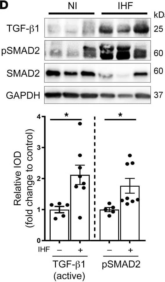 Western Blot LAP (TGF-beta 1) Antibody (7F6) - BSA Free