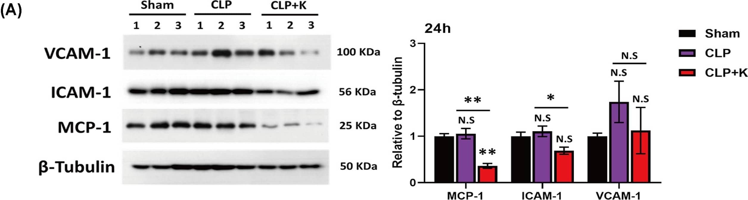 The production of MCP-1, VCAM-1, and ICAM-1 was significantly inhibited in Kaempferol treatment during sepsis(A) The protein expression level of MCP-1, VCAM-1, and ICAM-1 at 24 h; (B) protein expression level of MCP-1, VCAM-1, and ICAM-1 at 48 h in sham, saline-treated CLP mice, and kaempferol treated CLP mice (n = 3 per group, mean +/- S.E.M, *P<0.05, **P<0.01, ***P<0.001). Image collected and cropped by CiteAb from the following open publication (//pubmed.ncbi.nlm.nih.gov/37440431), licensed under a CC-BY license. Not internally tested by Novus Biologicals.